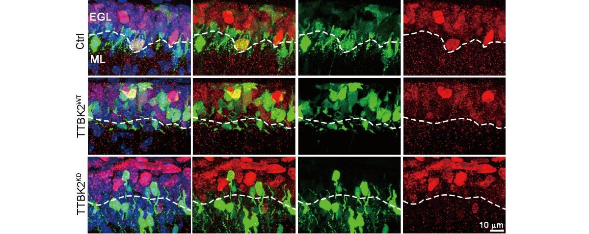 發現TTBK2 的活性能促進小腦顆粒神經前驅細胞（GNP）的增殖，顯示它在腦部發育與疾病中扮演關鍵角色。